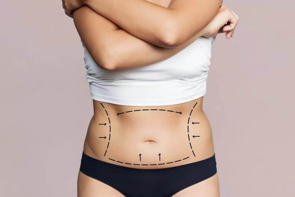 Abdominoplastia Ipanema: Guia Completo Sobre o Procedimento