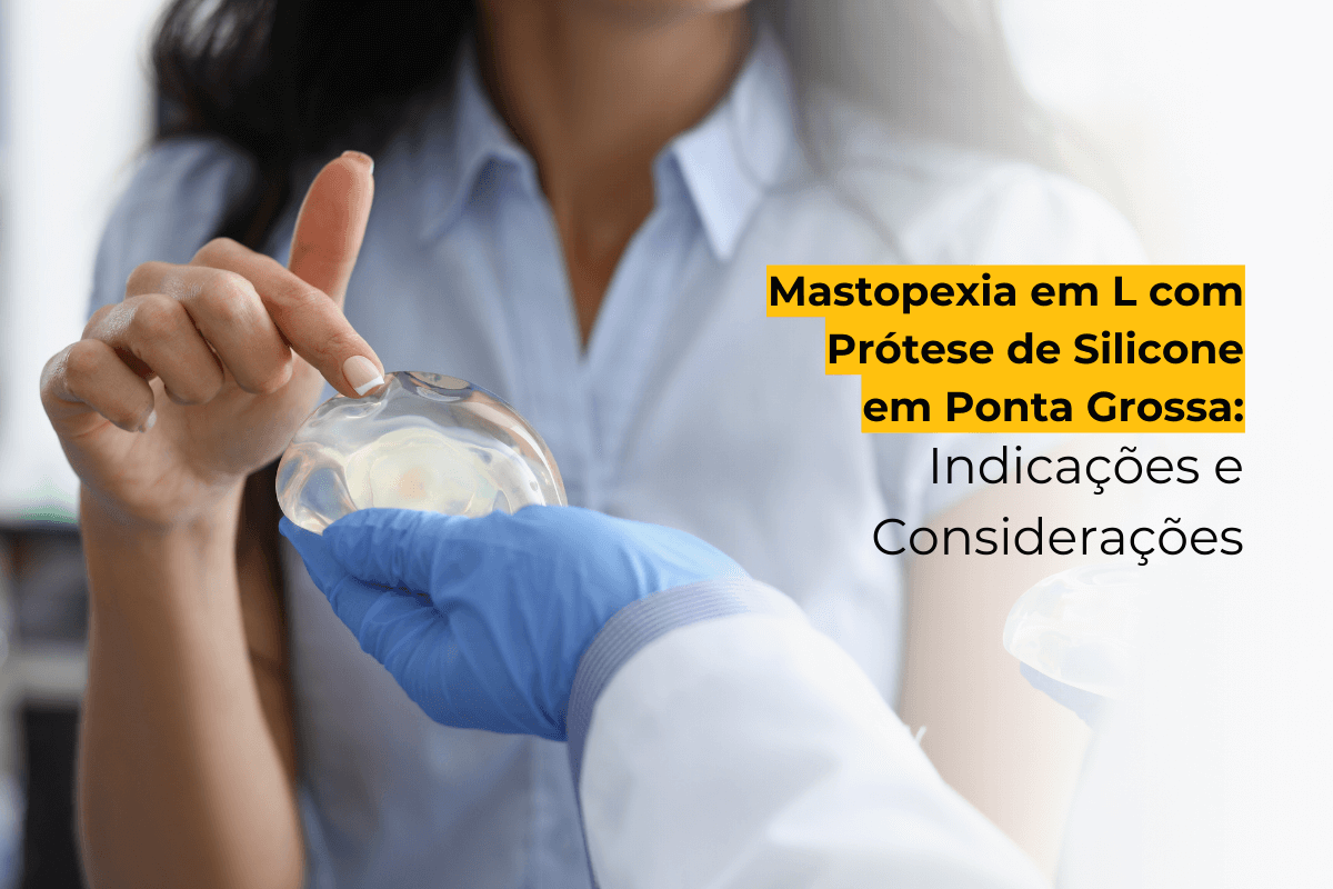 Mastopexia em L com Prótese de Silicone em Ponta Grossa: Indicações e Considerações