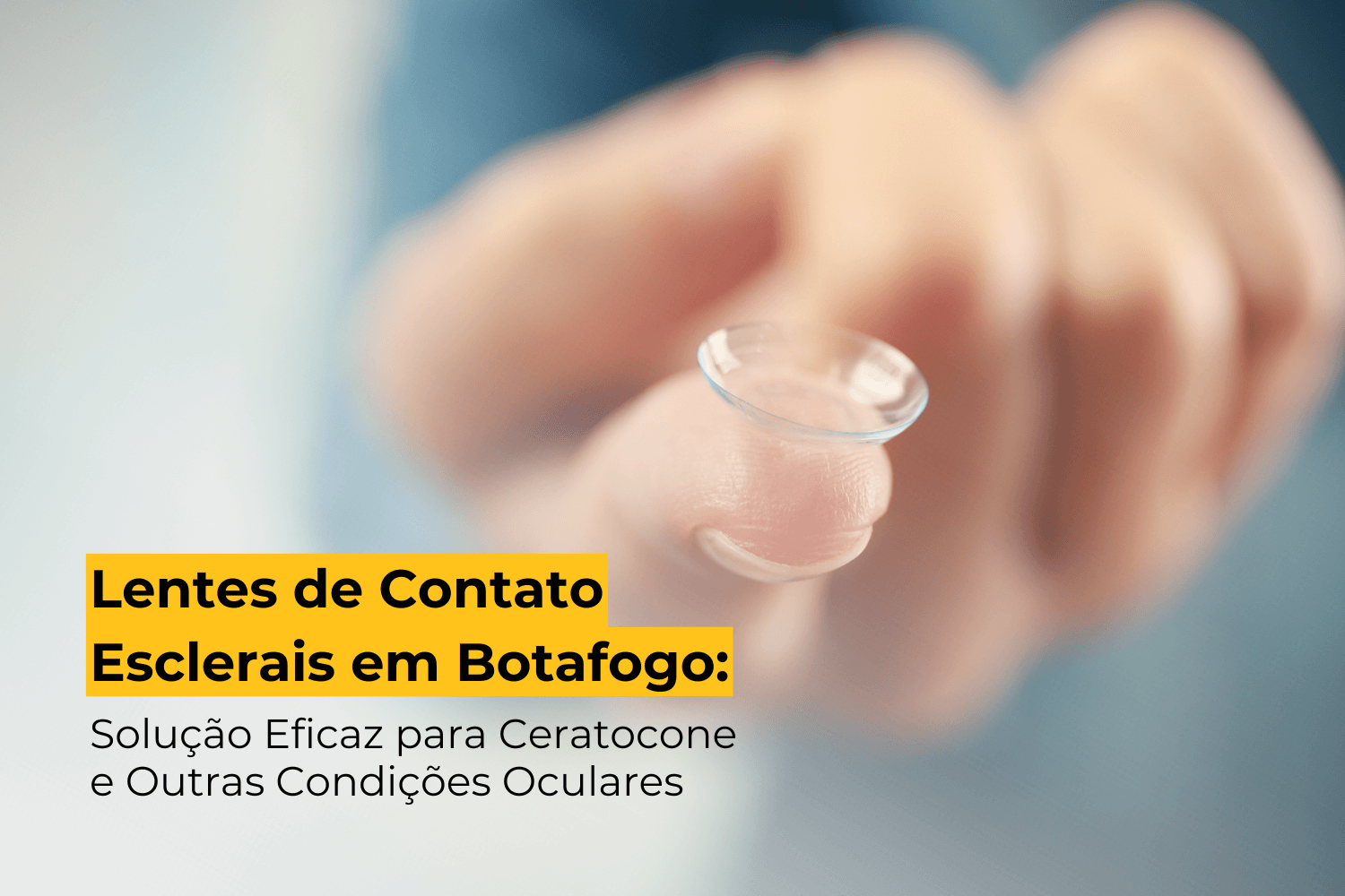 Lentes de Contato Esclerais em Botafogo: Solução Eficaz para Ceratocone e Outras Condições Oculares