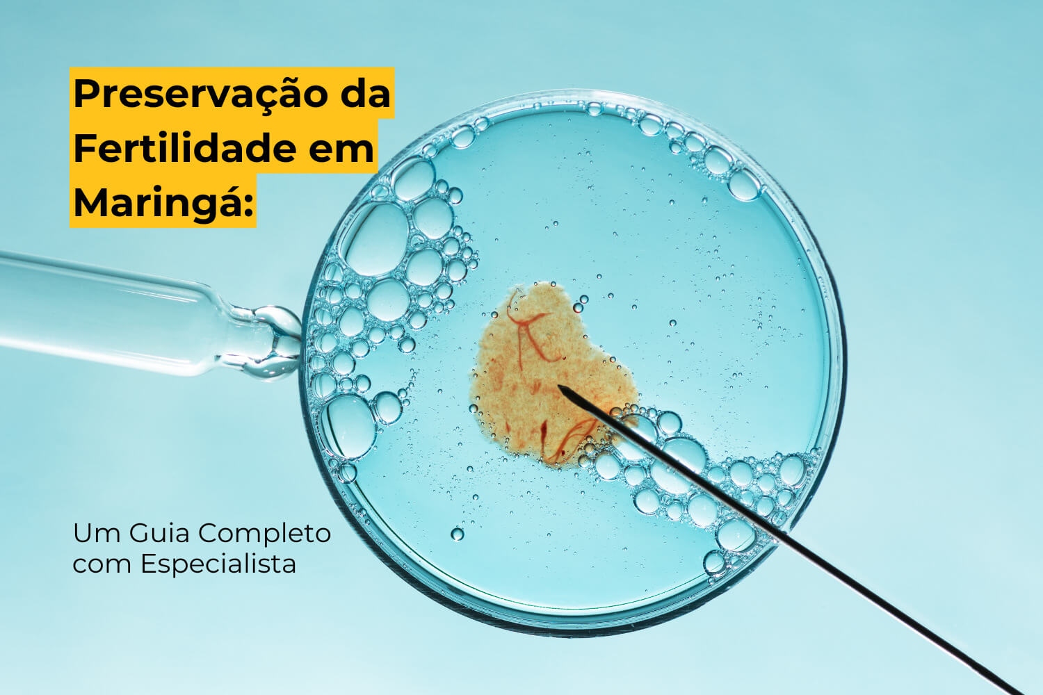 Preservação da Fertilidade em Maringá: Um Guia Completo com Especialista