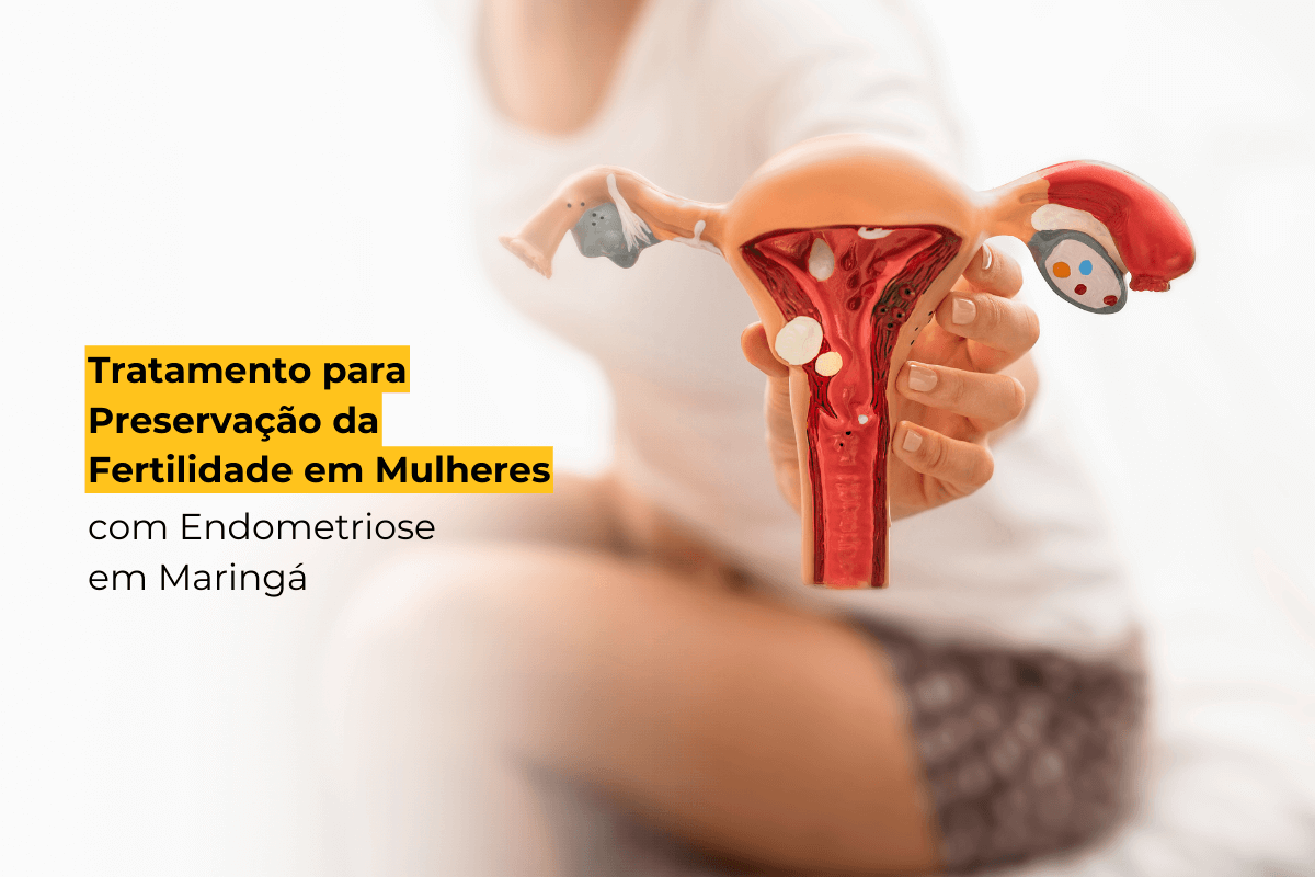 Tratamento para Preservação da Fertilidade em Mulheres com Endometriose em Maringá