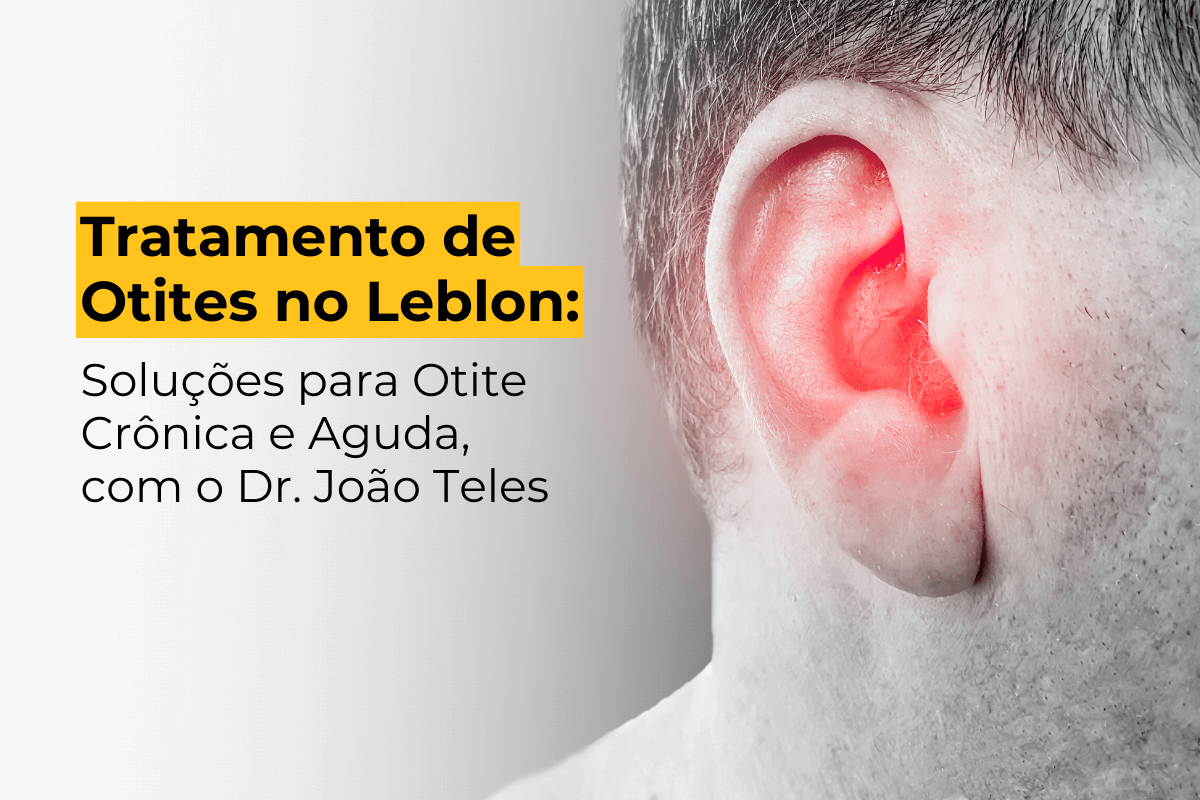 Tratamento de Otites no Leblon: Soluções para Otite Crônica e Aguda, com o Dr. João Teles