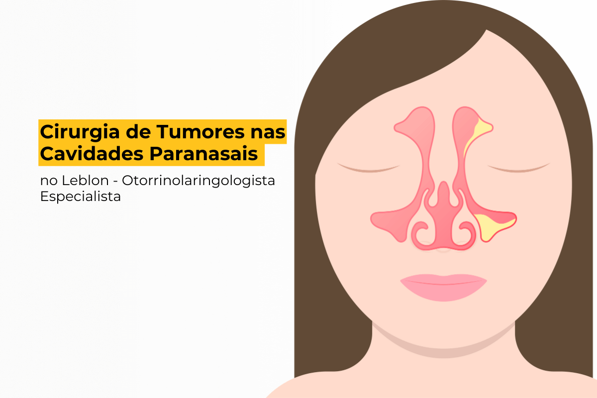 Cirurgia de Tumores nas Cavidades Paranasais no Leblon - Otorrinolaringologista Especialista