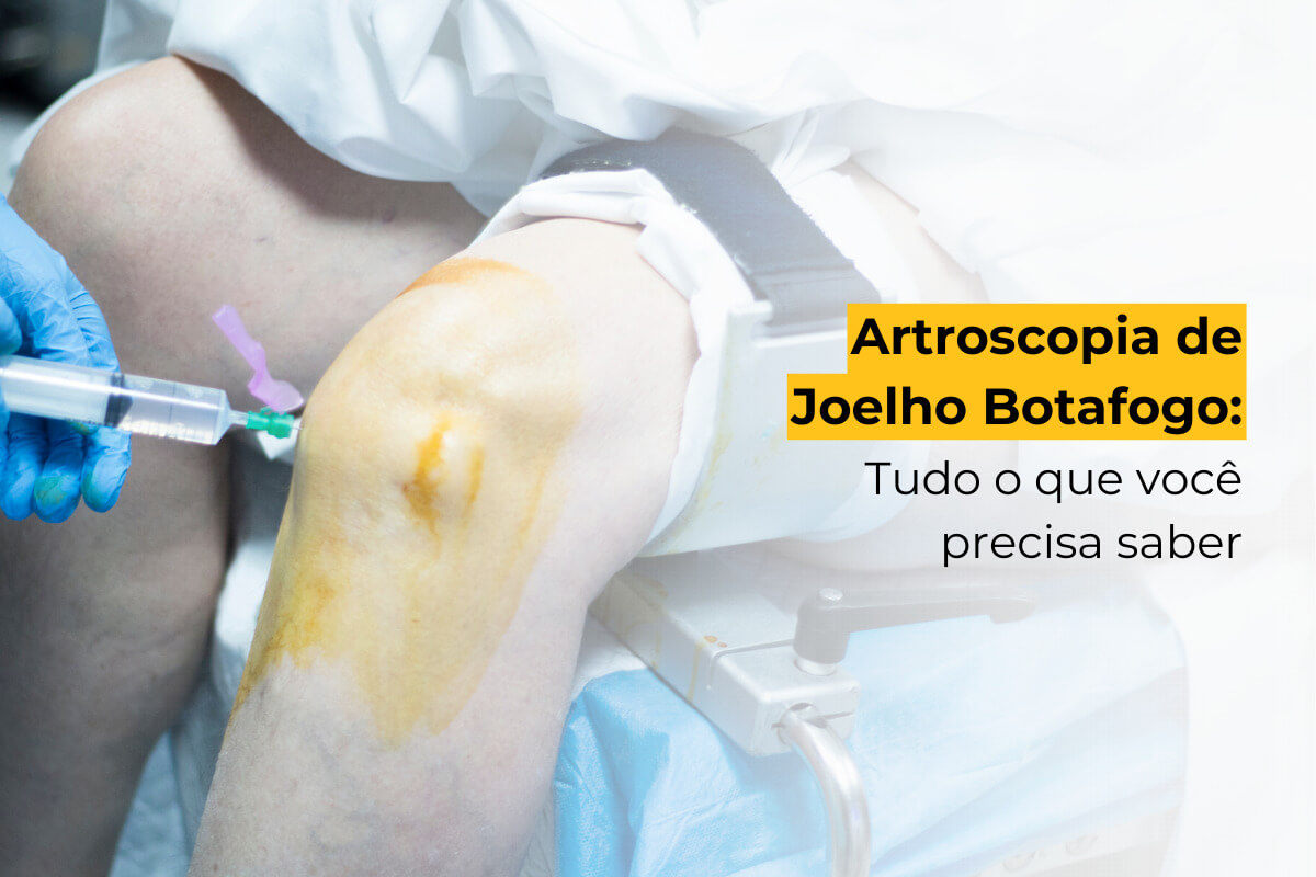 Ortopedista Botafogo: Agende Sua Consulta com o Dr. Marcos Britto - Artroscopia de joelho Botafogo