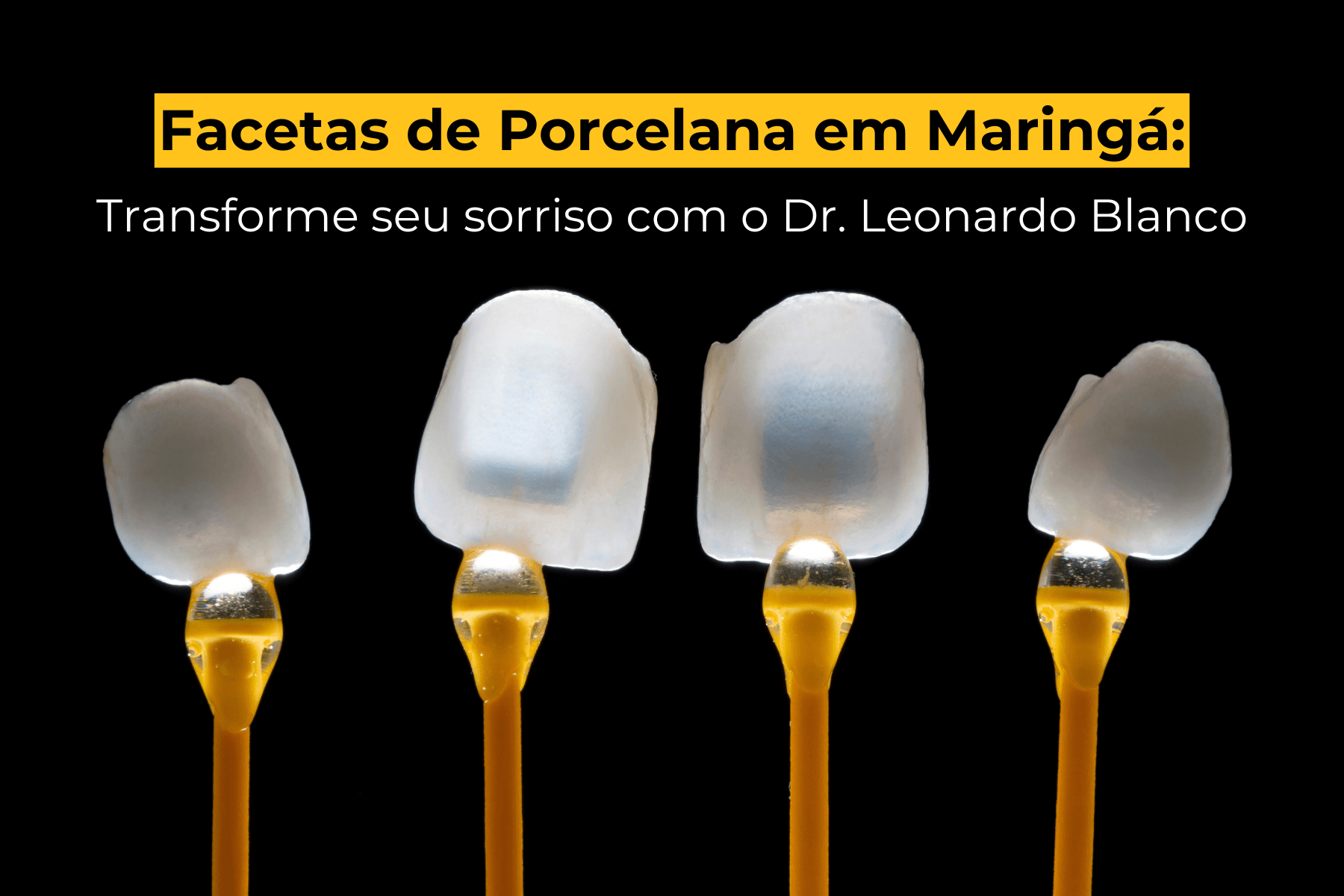 Facetas de Porcelana em Maringá: Transforme seu Sorriso com o Dr. Leonardo Blanco