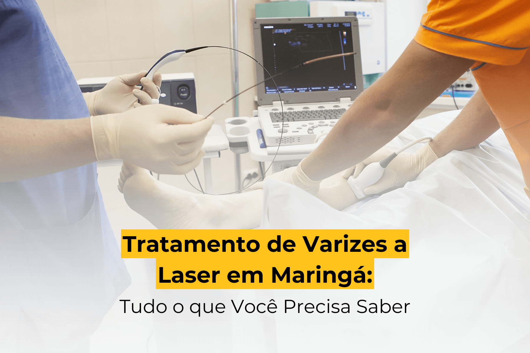 Tratamento de Varizes a Laser em Maringá: Tudo o que Você Precisa Saber