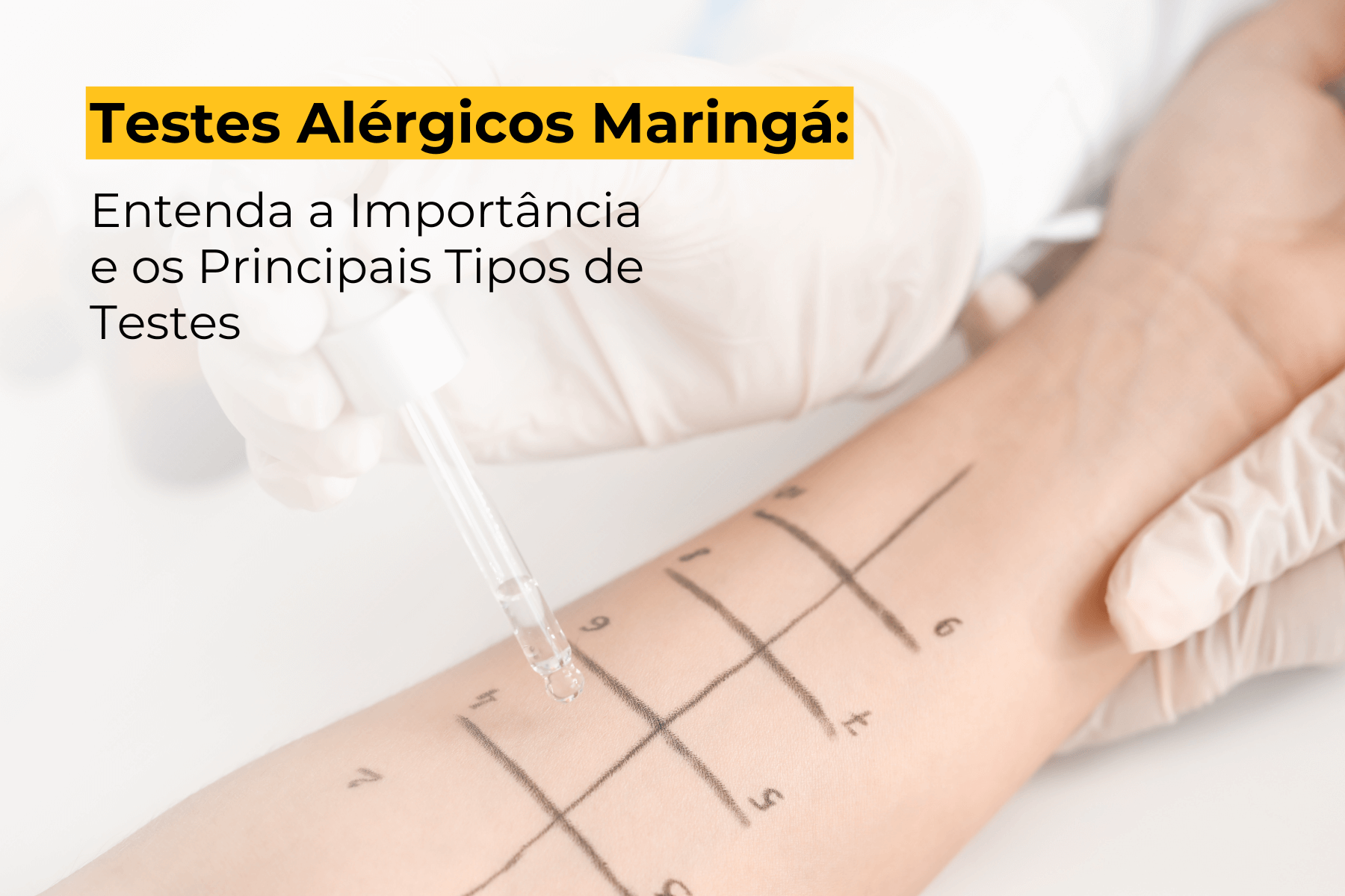 Testes Alérgicos Maringá: Entenda a Importância e os Principais Tipos de Testes