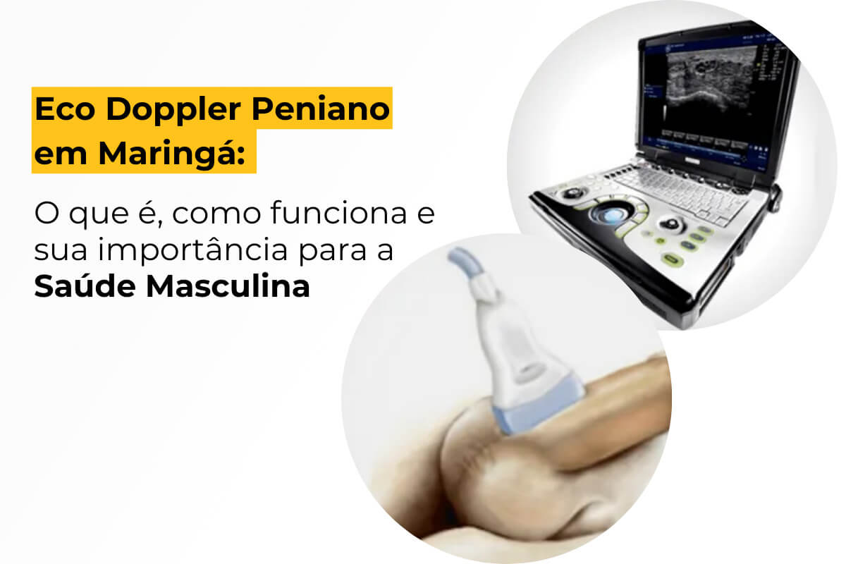 Eco Doppler Peniano em Maringá: O Que é, Como Funciona e Sua Importância para a Saúde Masculina