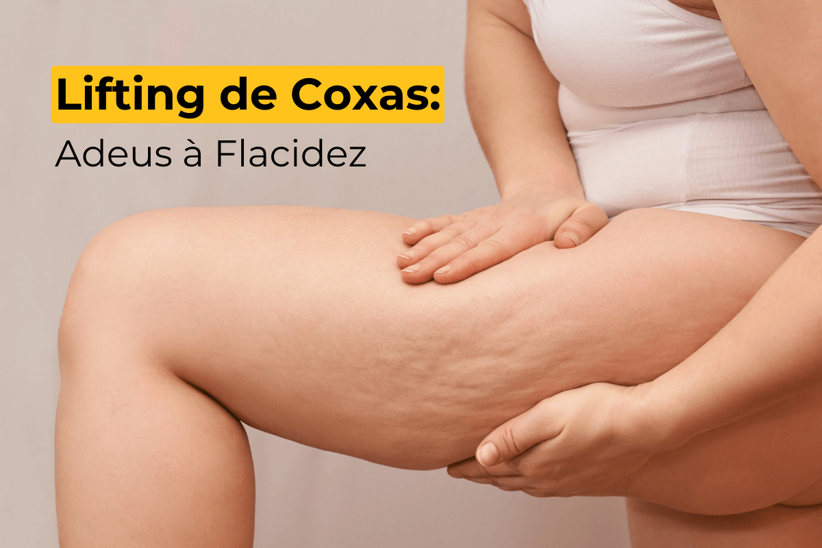 Lifting de Coxas em Guarujá: Adeus à Flacidez