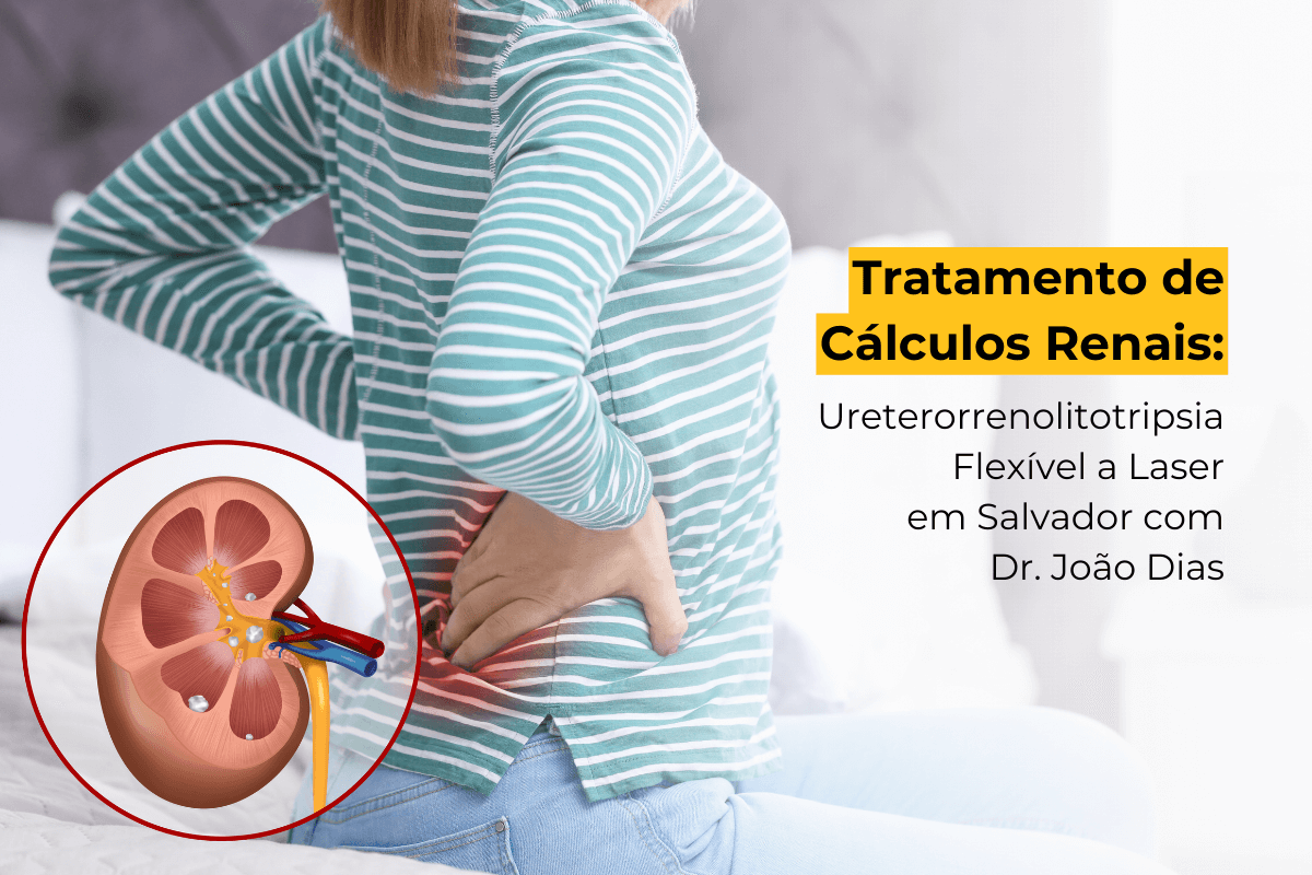 Tratamento de Cálculos Renais: Ureterorrenolitotripsia Flexível a Laser em Salvador com Dr. João Dias