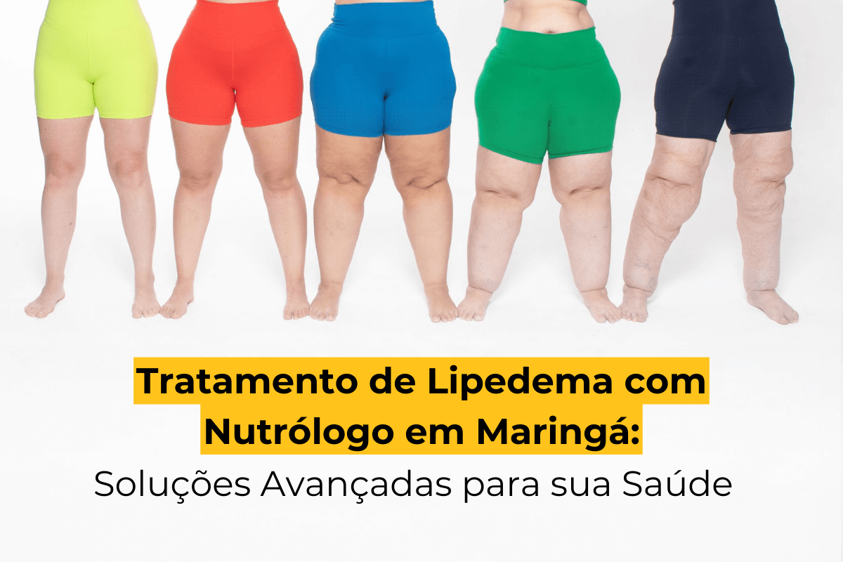 Tratamento de Lipedema com Nutrólogo em Maringá: Soluções Avançadas para sua Saúde