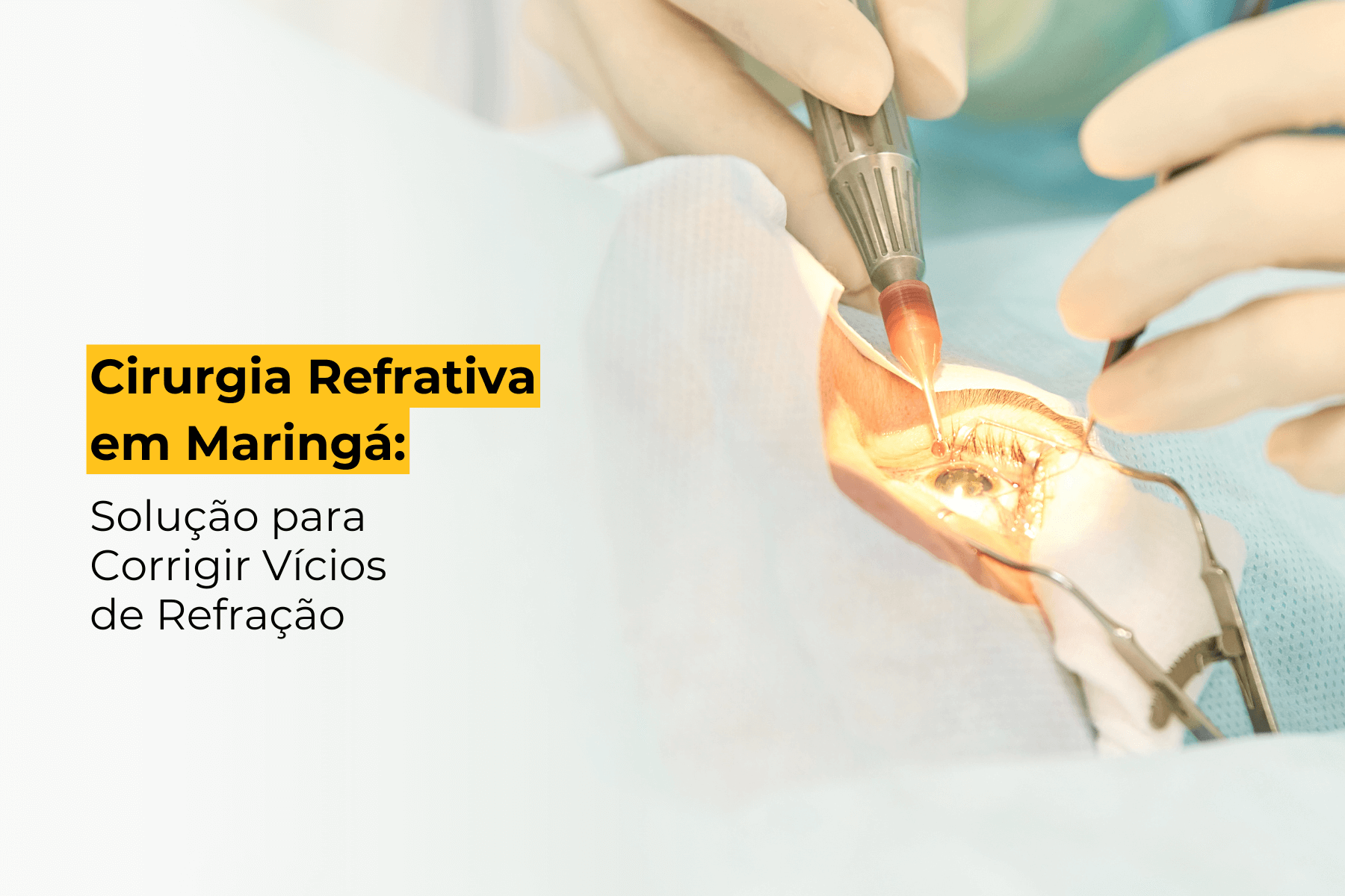 Cirurgia Refrativa em Maringá: Solução para Corrigir Vícios de Refração