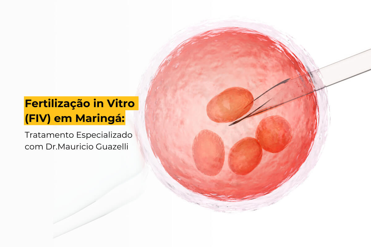 Fertilização in Vitro (FIV) em Maringá: Tratamento Especializado com Dr. Mauricio Guazelli