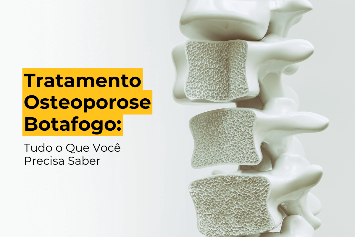 Tratamento Osteoporose Botafogo: Tudo o Que Você Precisa Saber