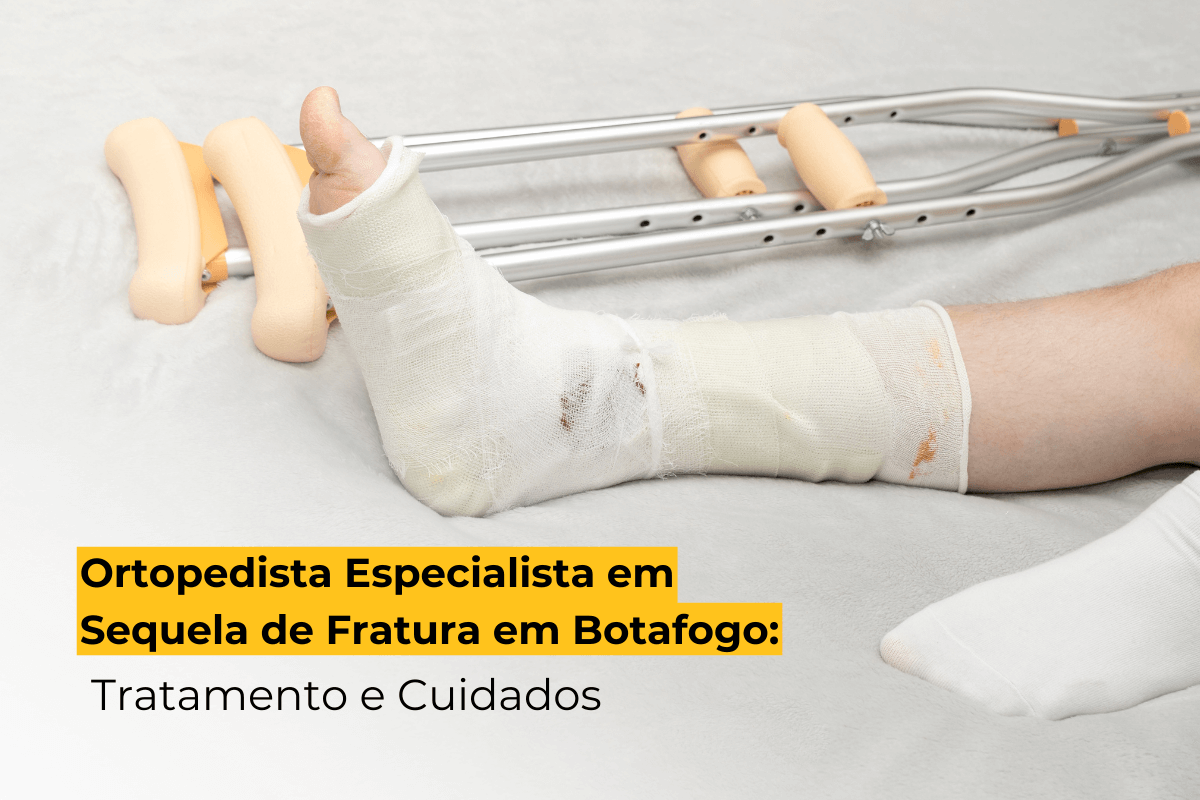 Ortopedista Especialista em Sequela de Fratura em Botafogo: Tratamento e Cuidados