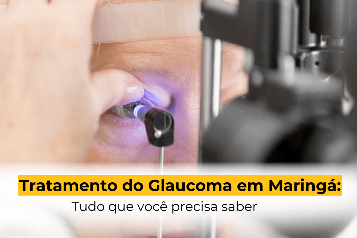 Tratamento do Glaucoma em Maringá: Tudo que Você Precisa Saber