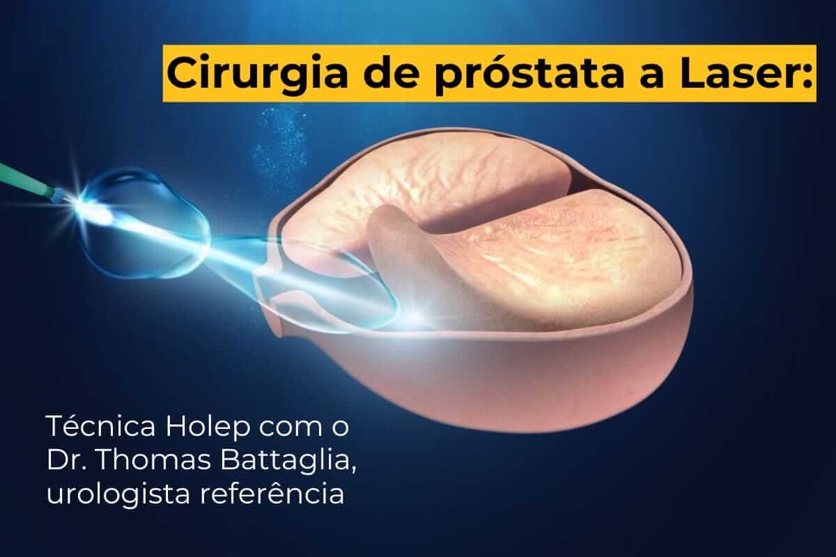 Cirurgia de Próstata a Laser em Maringá: Técnica Holep com o Dr. Thomas Battaglia, Urologista Referência