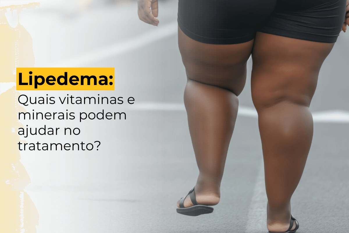 Lipedema Maringá: Quais Vitaminas e Minerais Podem Ajudar no Tratamento?