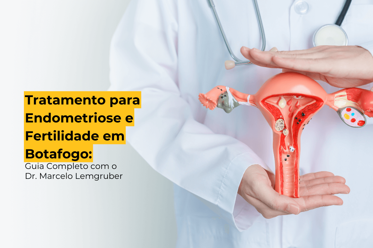 Tratamento para Endometriose e Fertilidade em Botafogo: Guia Completo com o Dr. Marcelo Lemgruber 