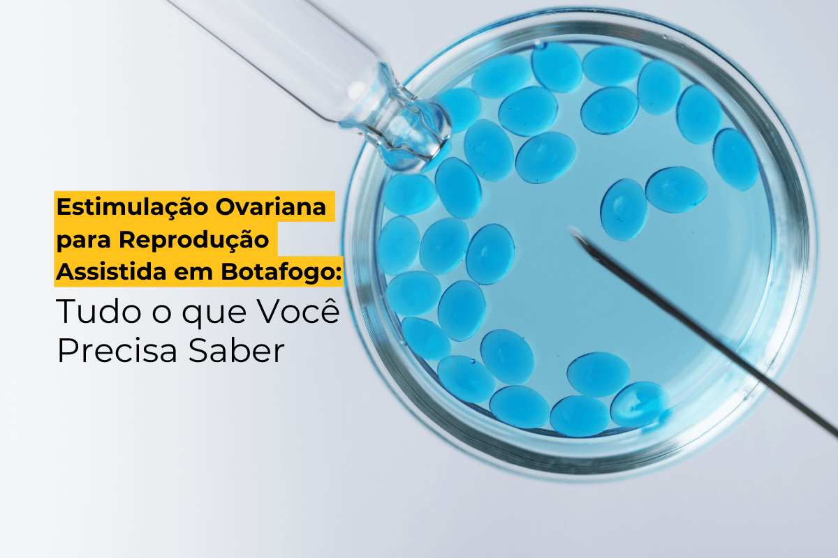 Estimulação Ovariana para Reprodução Assistida em Botafogo: Tudo o que Você Precisa Saber 