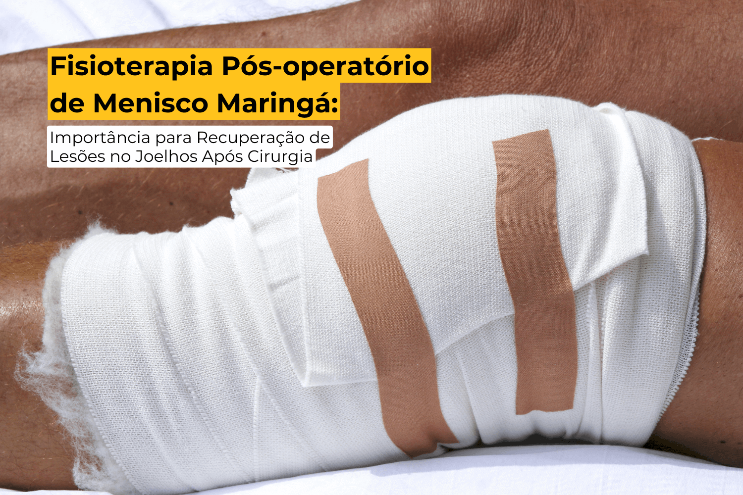 Fisioterapia Pós-operatório de Menisco Maringá: Importância para Recuperação de Lesões no Joelhos Após Cirurgia