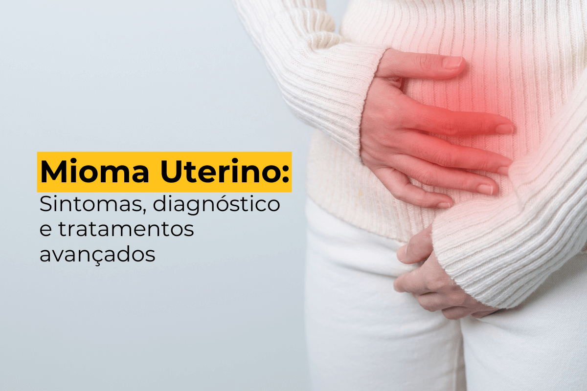 Mioma Uterino em Maringá: Sintomas, Diagnóstico e Tratamentos Avançados