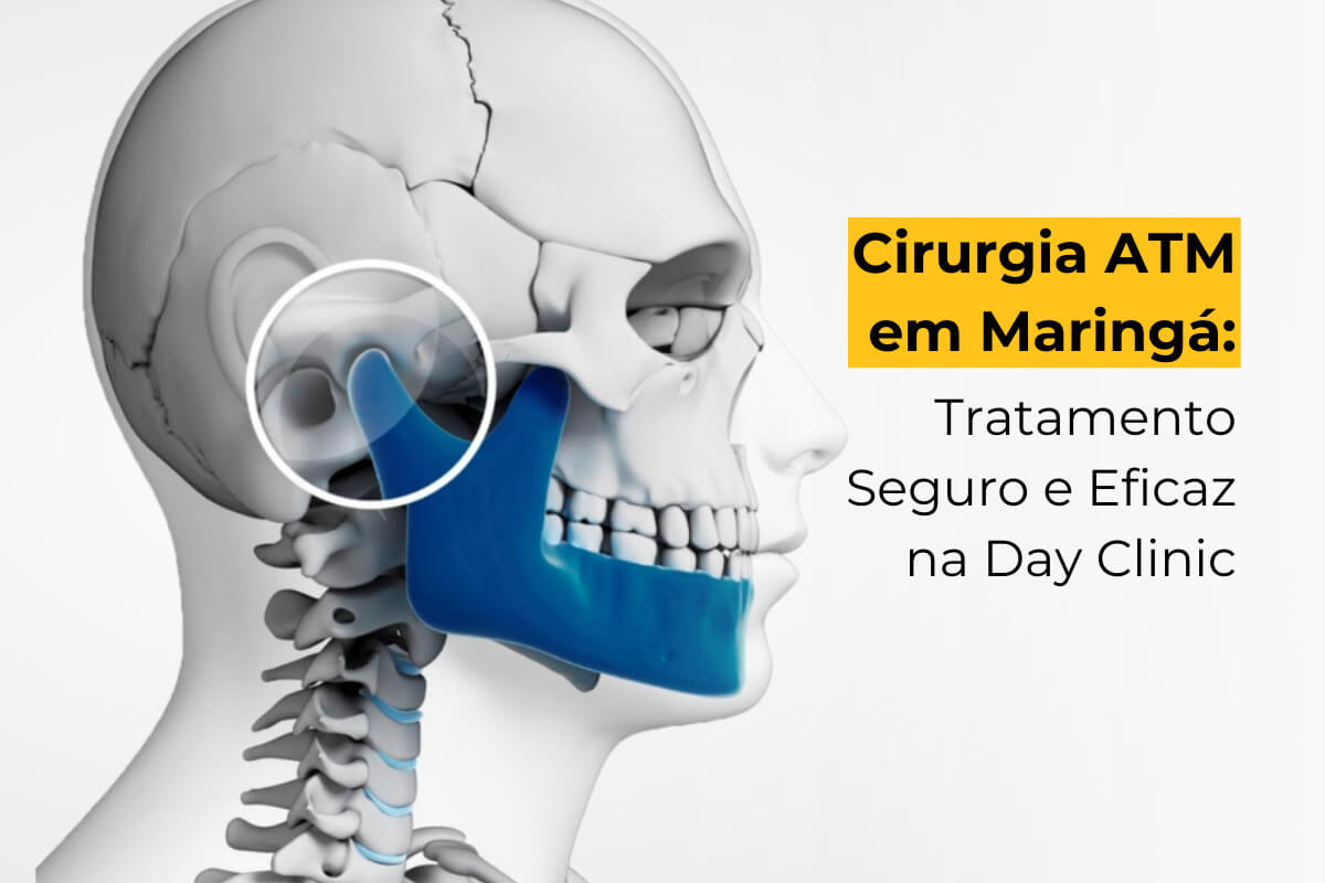 Cirurgia ATM em Maringá: Tratamento Seguro e Eficaz na Day Clinic