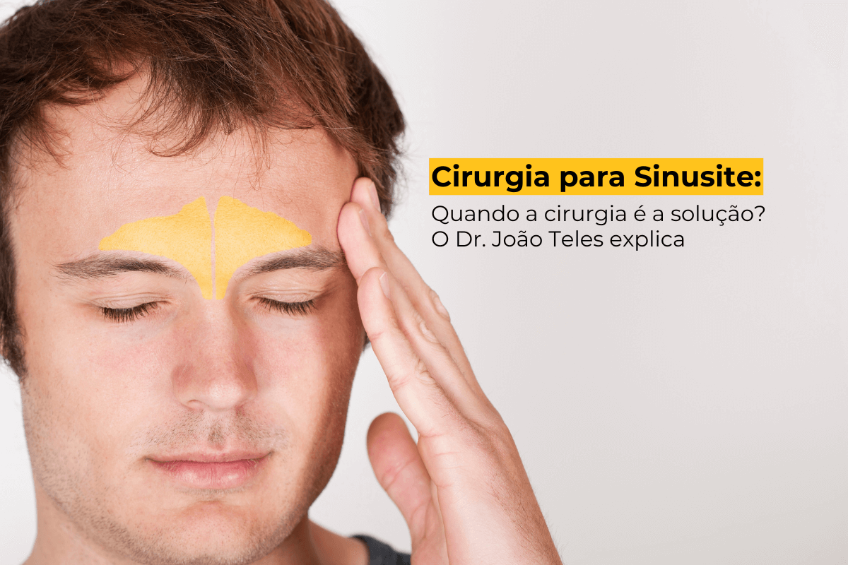 Cirurgia para Sinusite no Leblon: Quando a Cirurgia é a Solução? O Dr. João Teles Explica