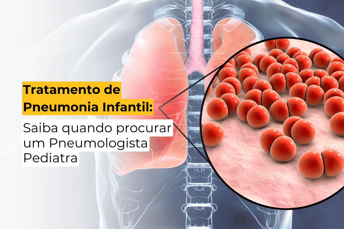 Tratamento de Pneumonia Infantil em Maringá: Saiba Quando Procurar um Pneumologista Pediatra