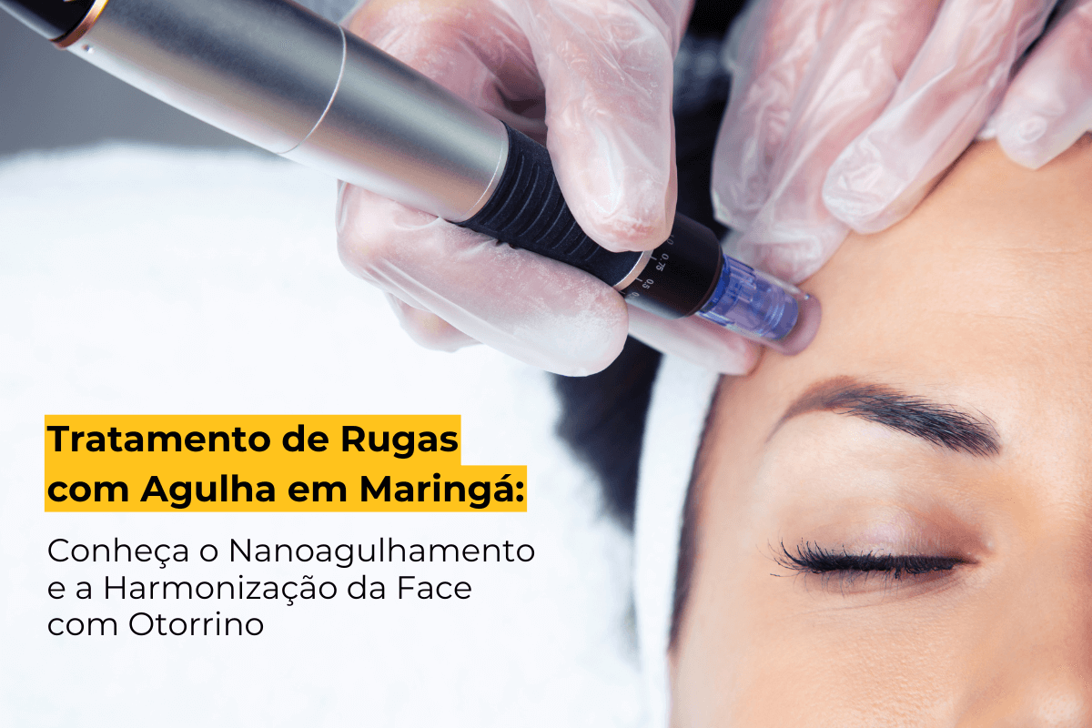 Tratamento de Rugas com Agulha em Maringá: Conheça o Nanoagulhamento e a Harmonização da Face com Otorrino