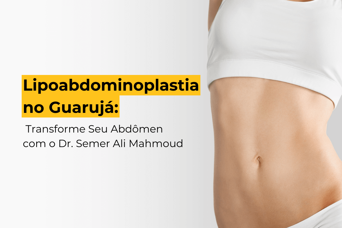 Lipoabdominoplastia no Guarujá: Transforme Seu Abdômen com o Dr. Semer Ali Mahmoud