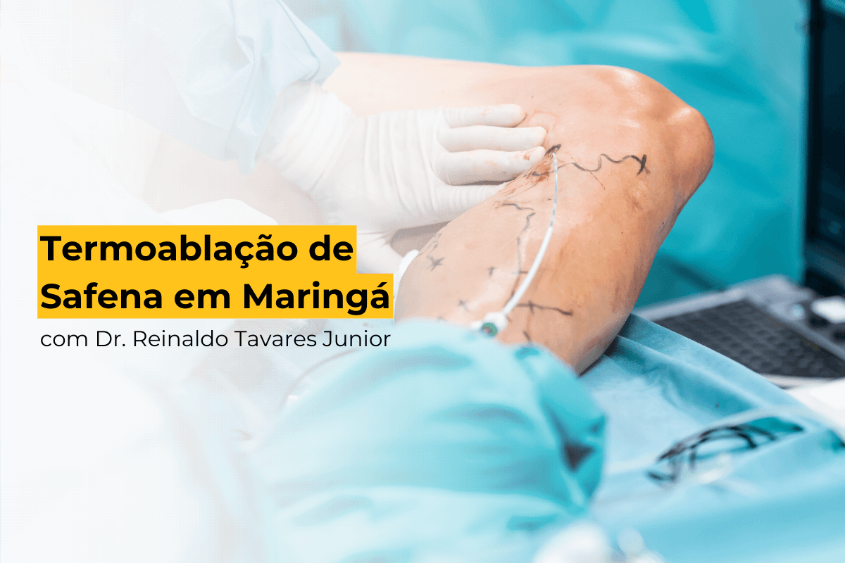 Termoablação de Safena em Maringá com Dr. Reinaldo Tavares Junior