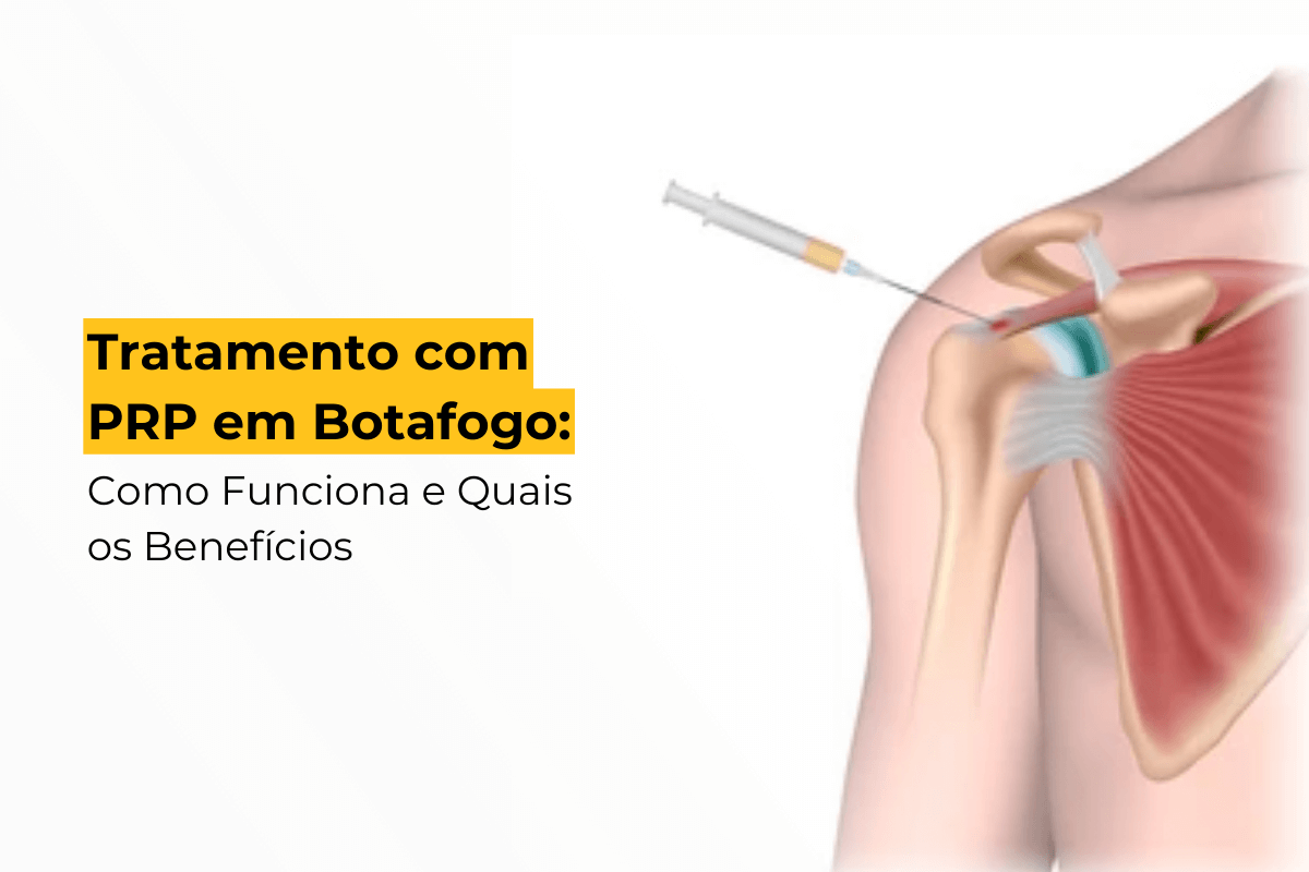 Tratamento com PRP em Botafogo: Como Funciona e Quais os Benefícios