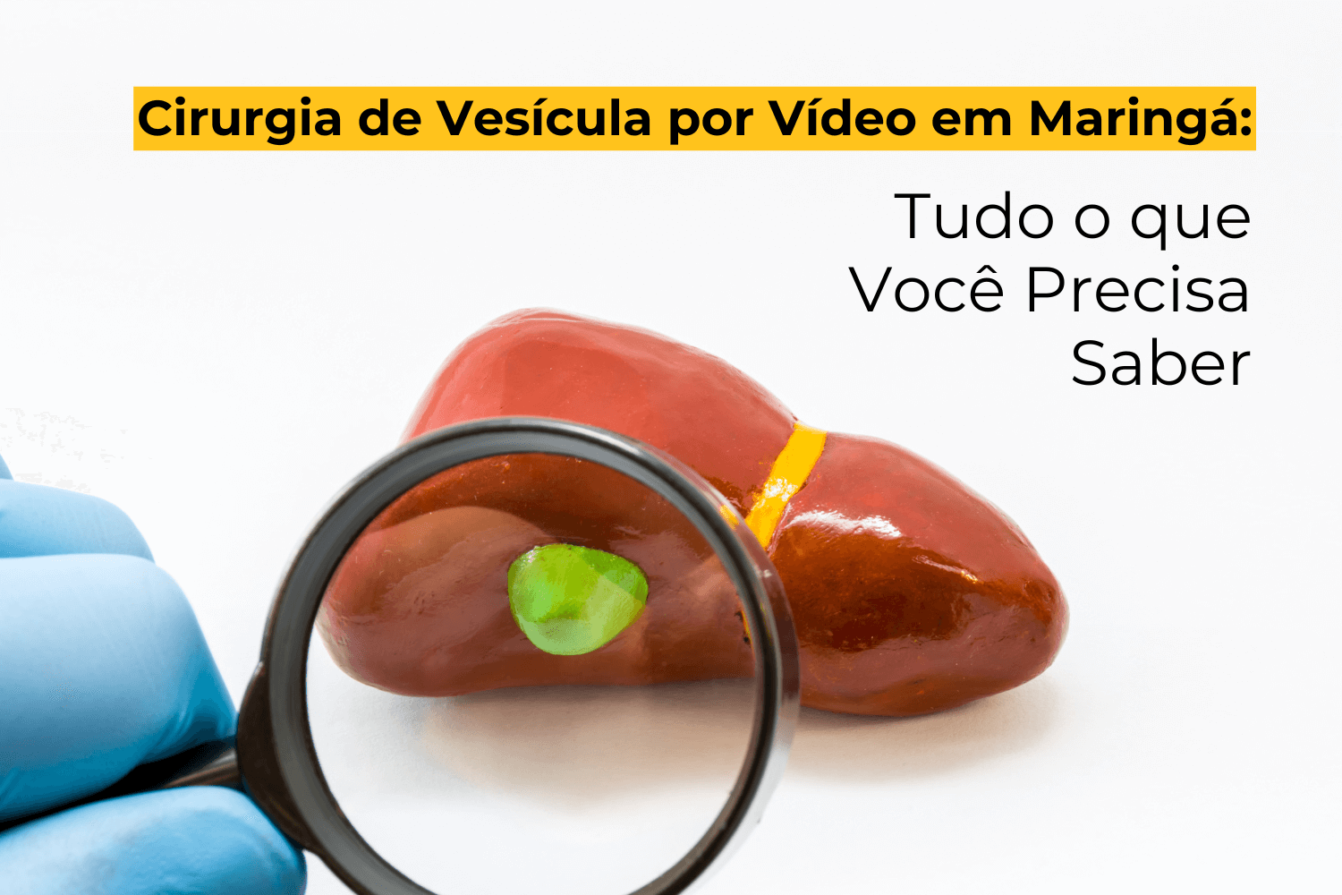 Cirurgia de Vesícula por Vídeo em Maringá: Tudo o que Você Precisa Saber