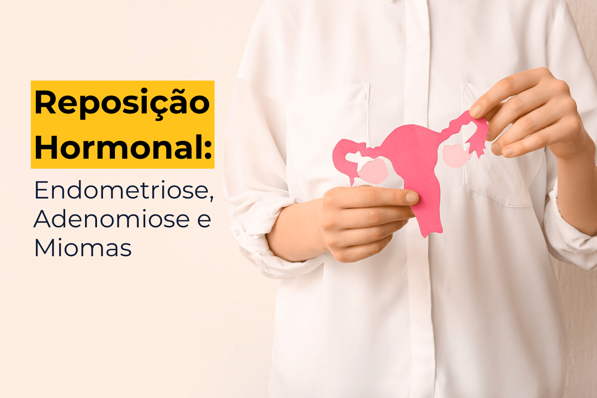 Terapia Hormonal Maringá: Endometriose, Adenomiose e Miomas