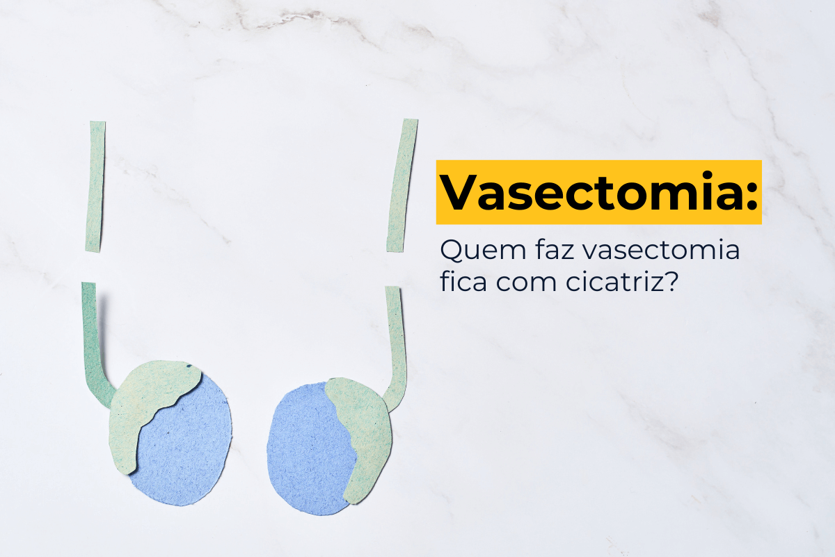 Vasectomia Maringá: Quem Faz Vasectomia Fica com Cicatriz?