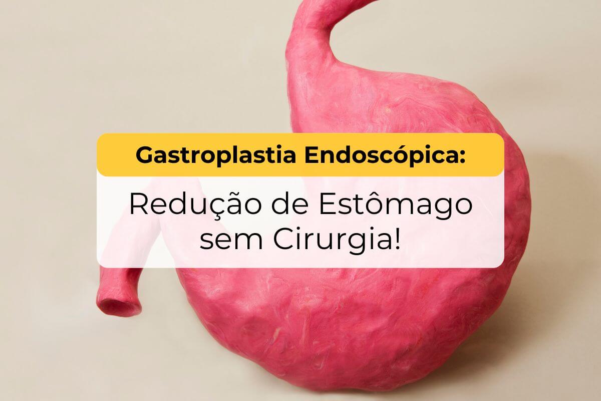 Gastroplastia Endoscópica Maringá: Redução de Estômago sem Cirurgia!