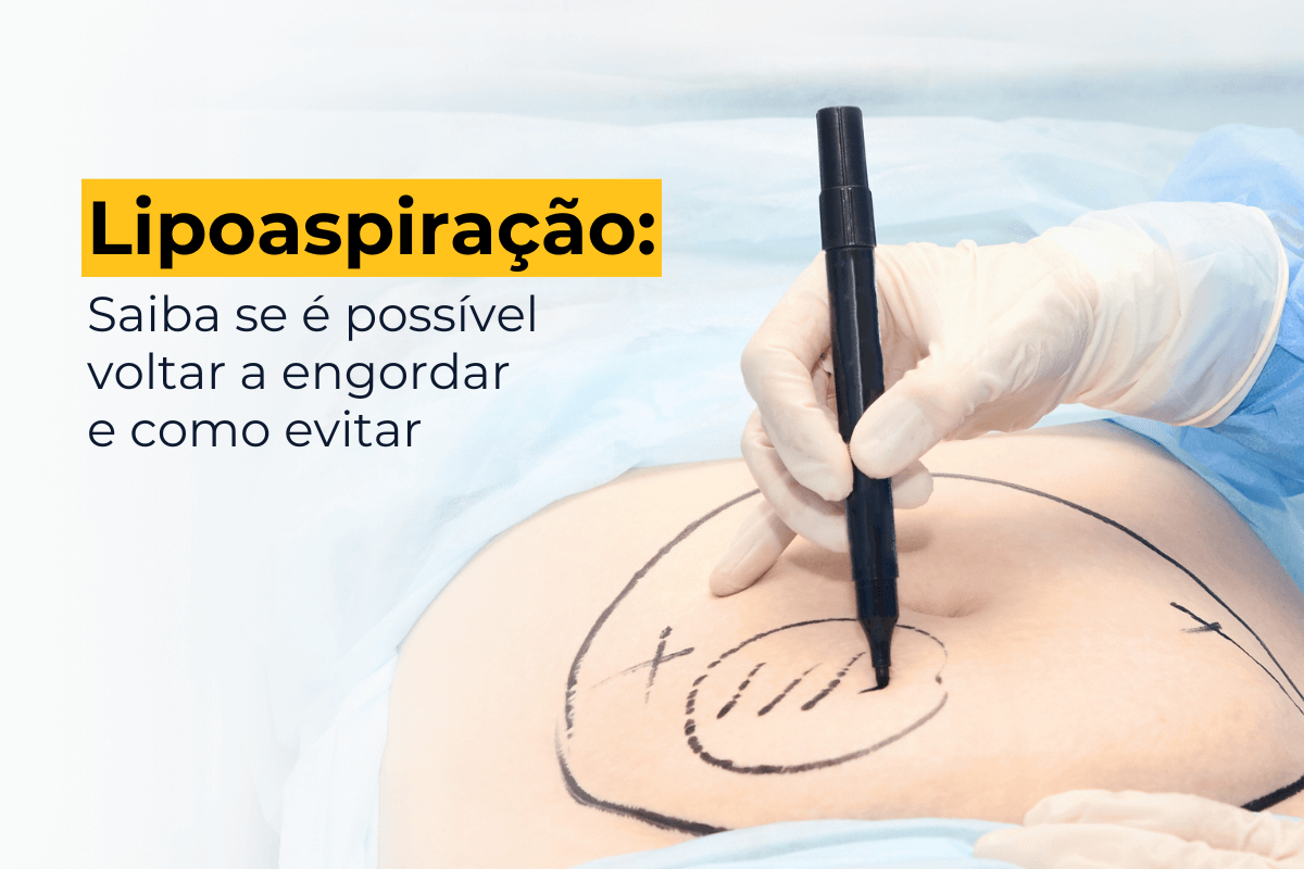 Lipoaspiração Ipanema: Saiba Se é Possível Voltar a Engordar e Como Evitar