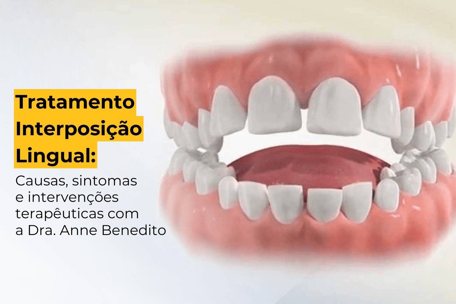 Tratamento Interposição Lingual Maringá: Causas, Sintomas e Intervenções Terapêuticas com a Dra. Anne Benedito