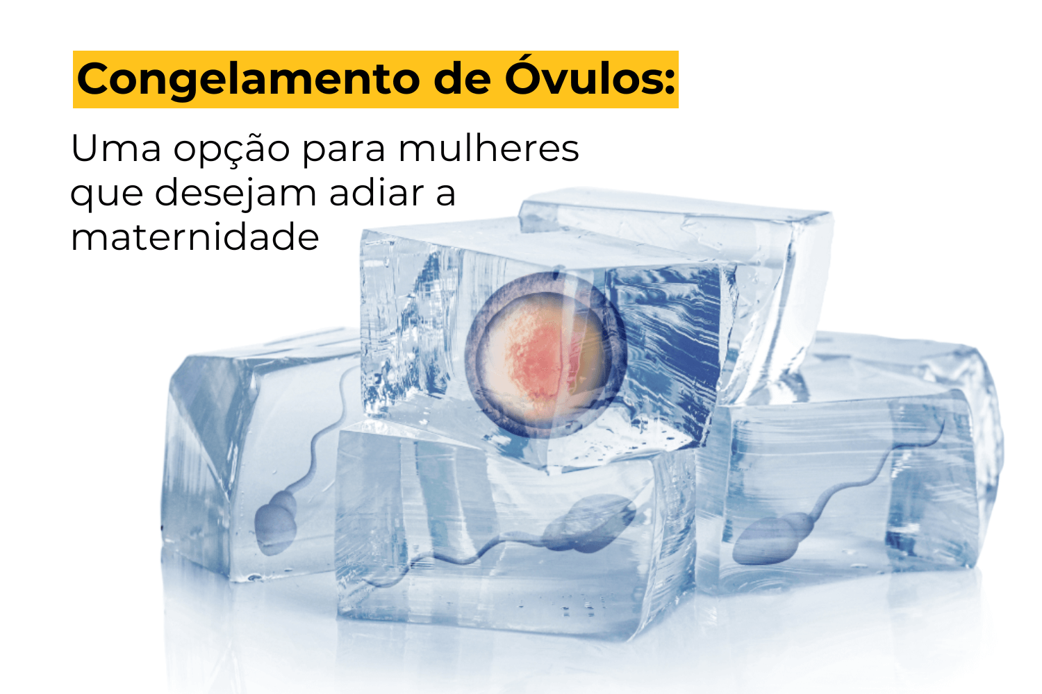 Congelamento de Óvulos Botafogo: Uma Opção para Mulheres que Desejam Adiar a Maternidade