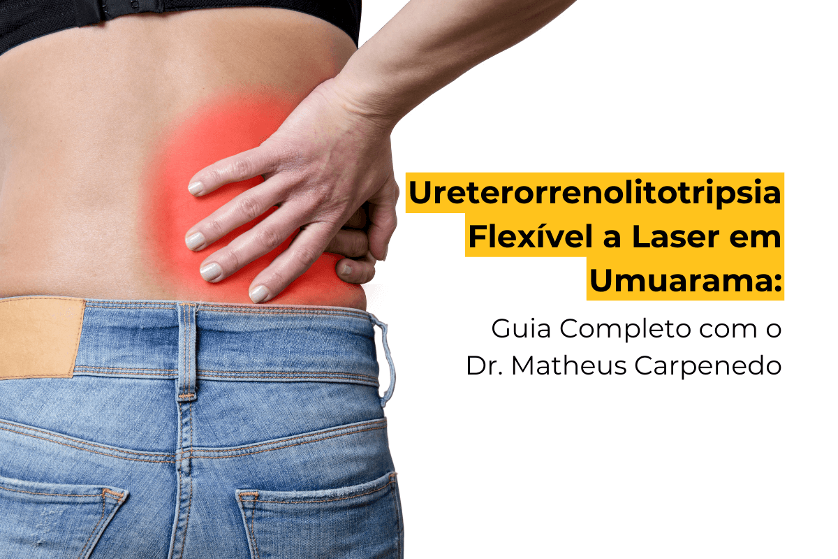 Ureterorrenolitotripsia Flexível a Laser em Umuarama: Guia Completo com o Dr. Matheus Carpenedo