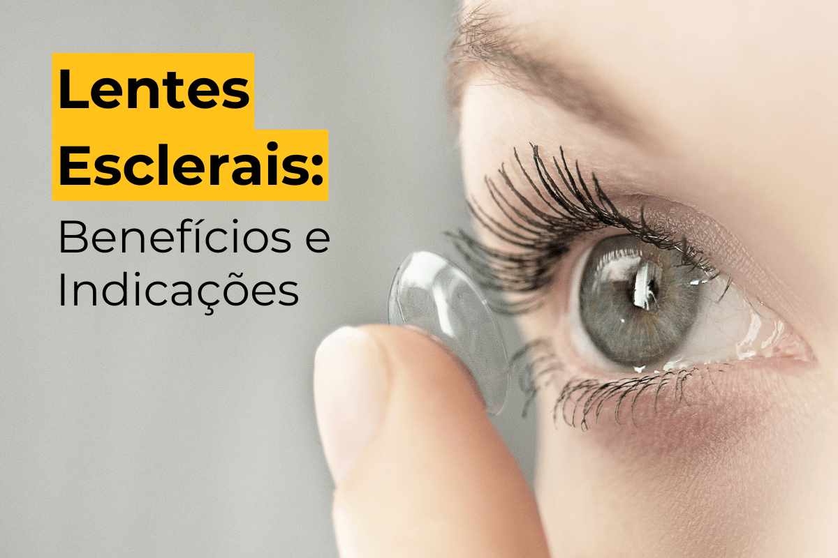 Lentes Esclerais em Botafogo: Benefícios e Indicações