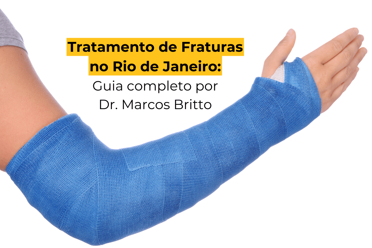 Tratamento de Fraturas no Rio de Janeiro: Guia Completo por Dr. Marcos Britto