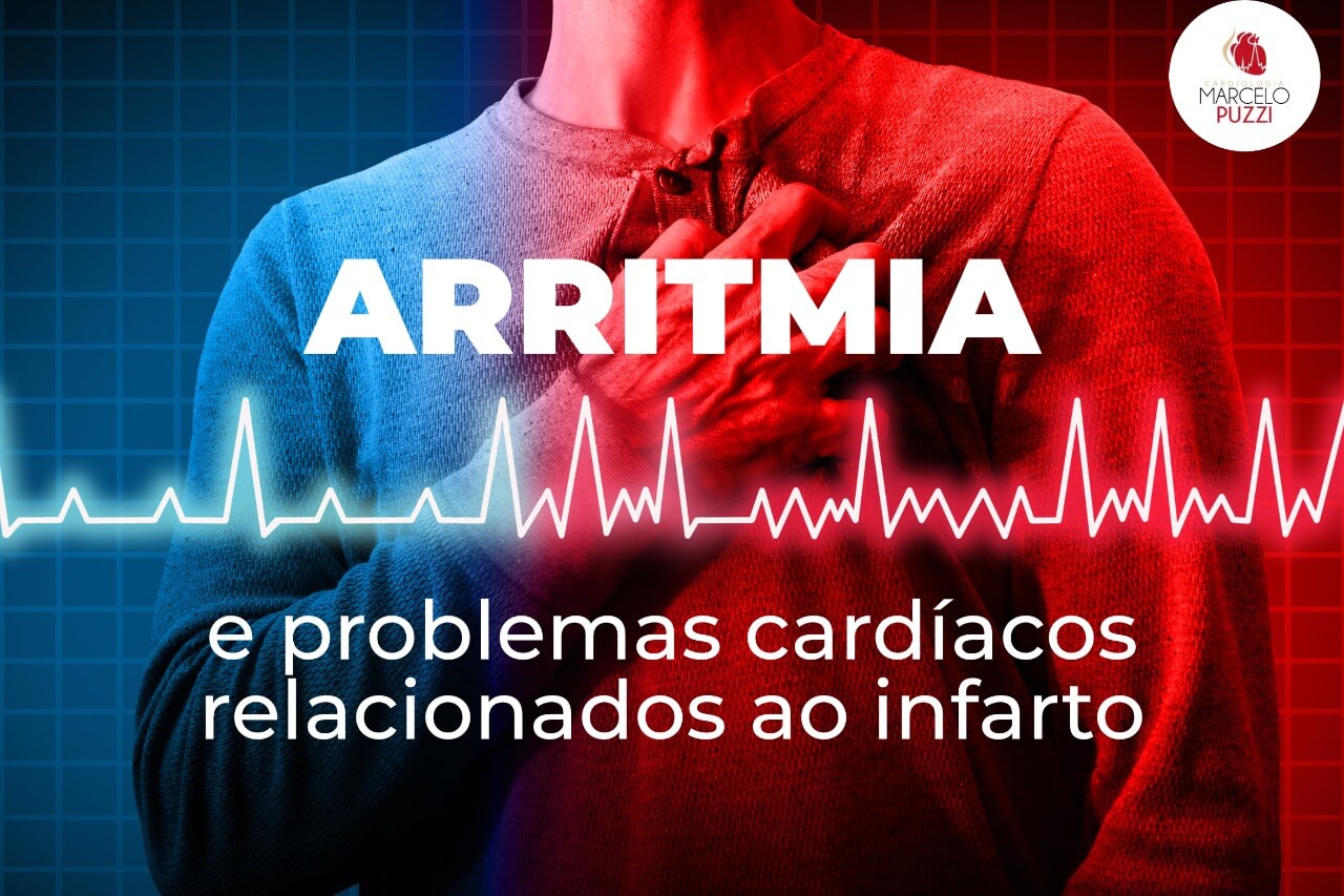 Arritmia e problemas cardíacos relacionados ao infarto