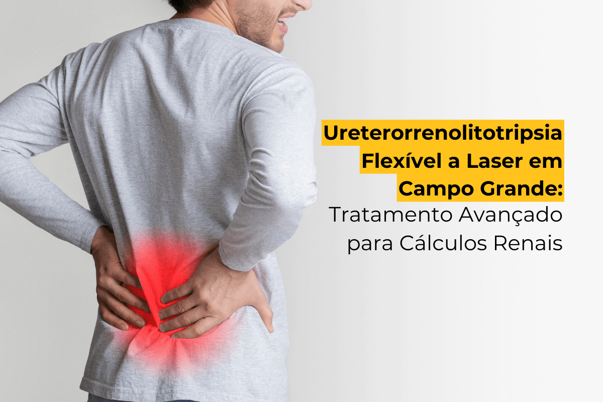 Ureterorrenolitotripsia Flexível a Laser em Campo Grande: Tratamento Avançado para Cálculos Renais