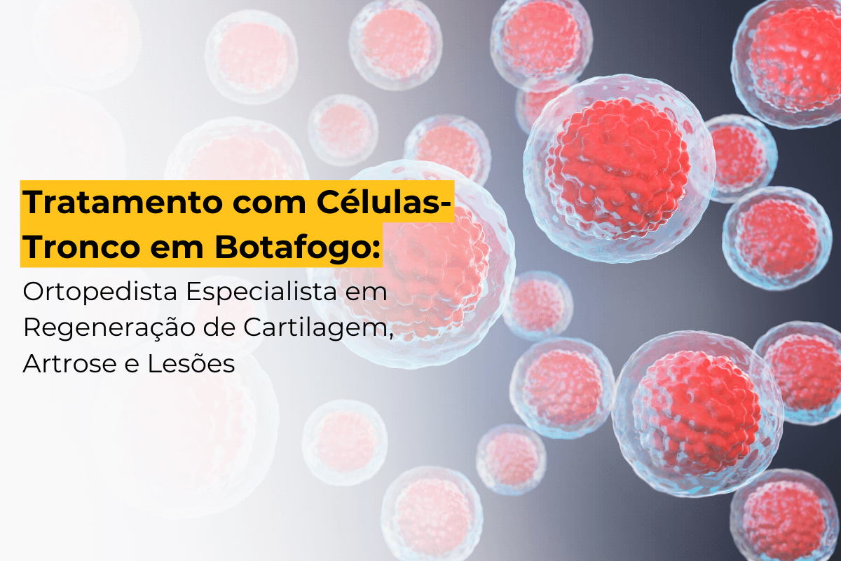 Tratamento com Células-Tronco em Botafogo: Ortopedista Especialista em Regeneração de Cartilagem, Artrose e Lesões