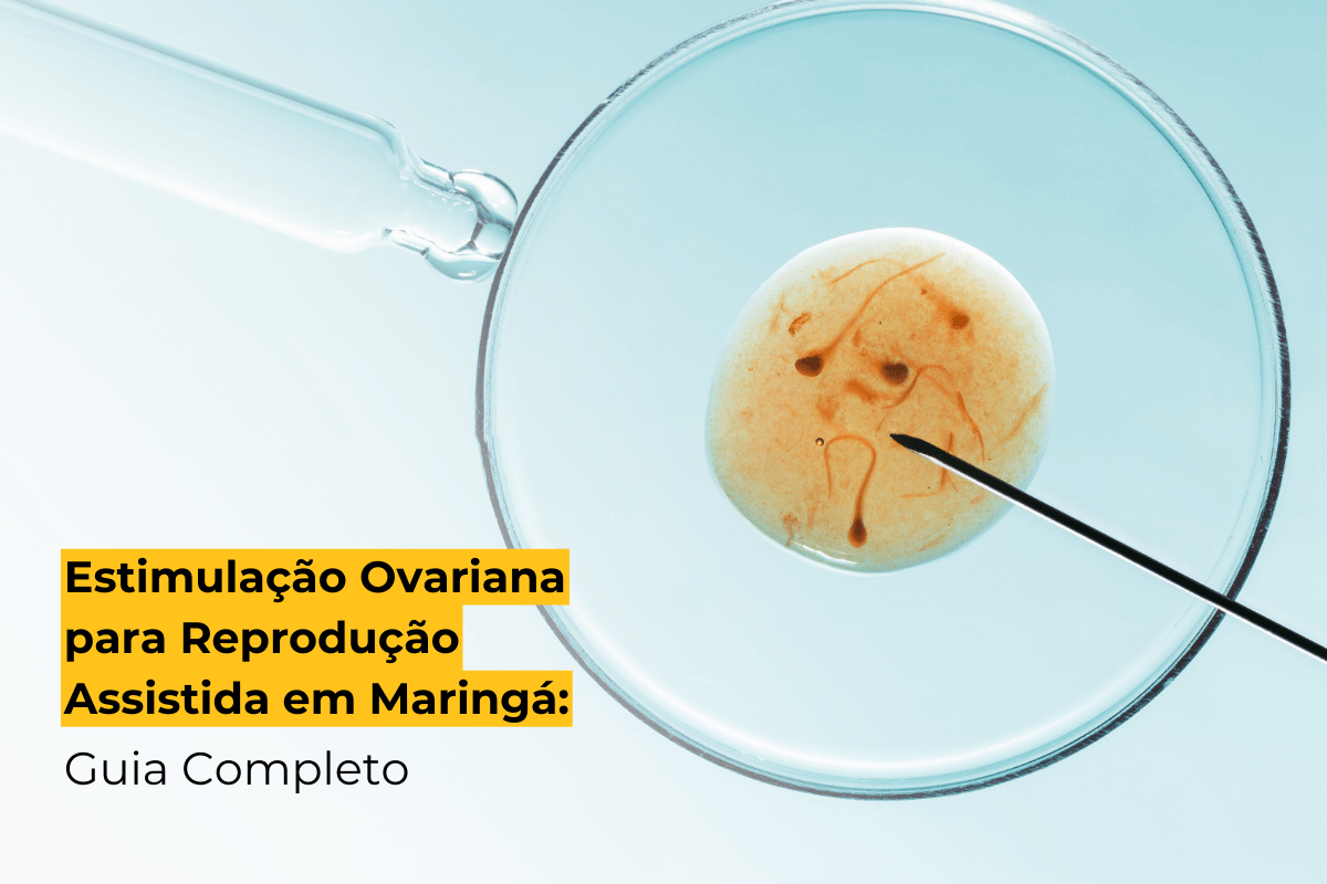 Estimulação Ovariana para Reprodução Assistida em Maringá: Guia Completo