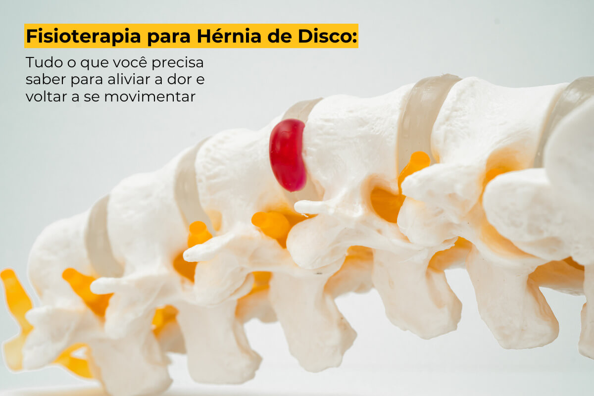 Fisioterapia para Hérnia de Disco Maringá: Tudo o que você precisa saber para aliviar a dor e voltar a se movimentar