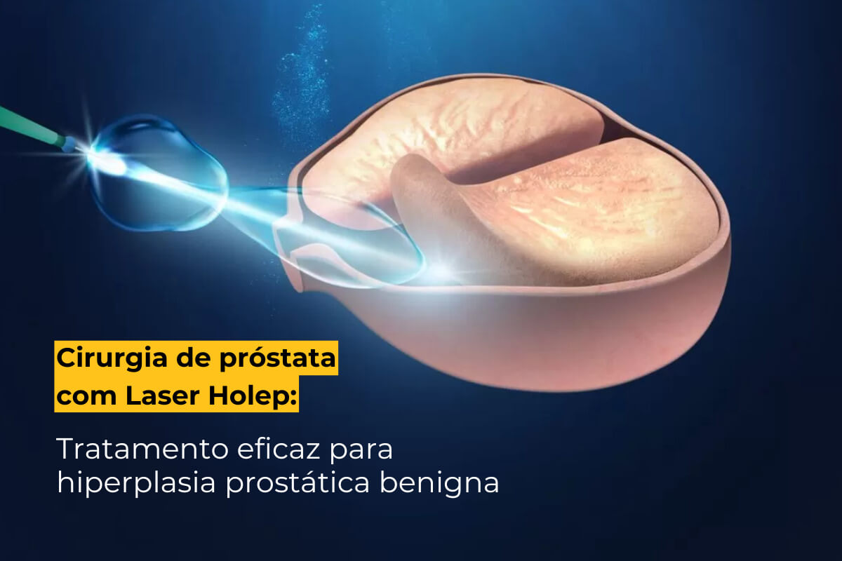 Cirurgia de Próstata com Laser Holep em Maringá: Tratamento Eficaz para Hiperplasia Prostática Benigna