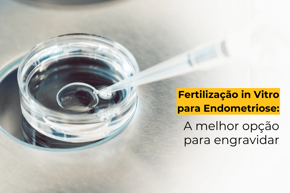 Fertilização in Vitro para Endometriose em Maringá: A Melhor Opção para Engravidar